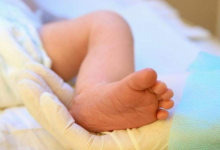 Yenidoğan Sarılığı Nedir, Bebeklerde Sarılık Nasıl Geçer