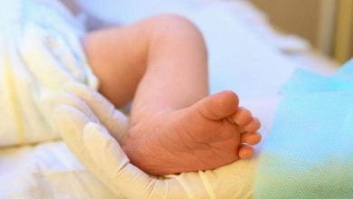 Yenidoğan Sarılığı Nedir, Bebeklerde Sarılık Nasıl Geçer
